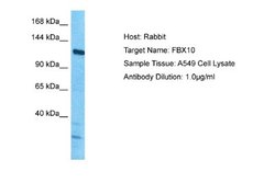 FBX10 Rabbit anti-Human, Polyclonal, Novus Biologicals 0.1 mL | Buy Online | Novus Biologicals | Fisher Scientific